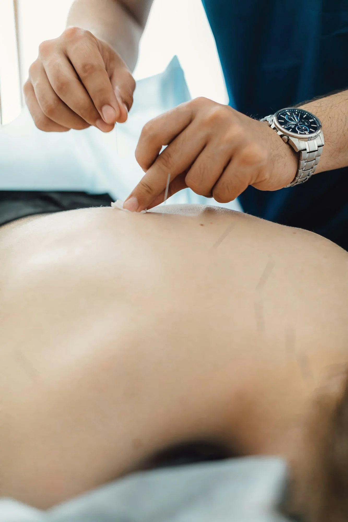 Woman stabbed in the back with needle in bright acupuncture clinic
